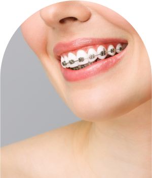 Clear Braces Clinic in Royal Palm Beach, West Palm Beach, and Lantana, FL
