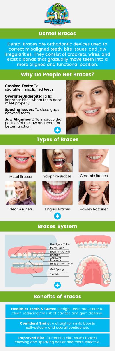 Common questions asked by patients: Which age is best for teeth braces? What are dental braces called? What is stage 4 of braces? What disqualifies you from braces? What's the most painful stage of braces? For more information, contact us or request an appointment online. We are conveniently located at 1962 S Military Trl Suite B, West Palm Beach, FL 33415. We serve patients from West Palm Beach FL, Palm Springs FL, Greenacres FL, Lantana FL, Wellington FL, Boynton FL, and surrounding areas. Common questions asked by patients: Which age is best for teeth braces? What are dental braces called? What is stage 4 of braces? What disqualifies you from braces? What's the most painful stage of braces? For more information, contact us or request an appointment online. We are conveniently located at 1962 S Military Trl Suite B, West Palm Beach, FL 33415. We serve patients from West Palm Beach FL, Palm Springs FL, Greenacres FL, Lantana FL, Wellington FL, Boynton FL, and surrounding areas.