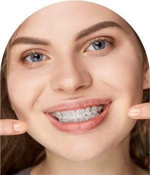 Dental Braces in Royal Palm Beach, West Palm Beach, and Lantana, FL
