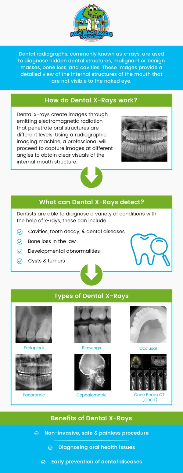 Common questions asked by patients: What is a dental X-ray, and why is it important for oral health? How often should you get a dental X-ray? Are dental X-rays safe, and do they involve any risks? What can a dental X-ray reveal that a regular examination might not? For more information, contact us or request an appointment online. We serve patients from Royal Palm Beach, FL, West Palm Beach, FL, and Lantana, FL Palm Springs FL, Greenacres FL, Wellington FL, Riviera Beach FL, Juno Beach FL, Delray Beach FL, and surrounding areas. Common questions asked by patients: What is a dental X-ray, and why is it important for oral health? How often should you get a dental X-ray? Are dental X-rays safe, and do they involve any risks? What can a dental X-ray reveal that a regular examination might not? For more information, contact us or request an appointment online. We serve patients from Royal Palm Beach, FL, West Palm Beach, FL, and Lantana, FL Palm Springs FL, Greenacres FL, Wellington FL, Riviera Beach FL, Juno Beach FL, Delray Beach FL, and surrounding areas.