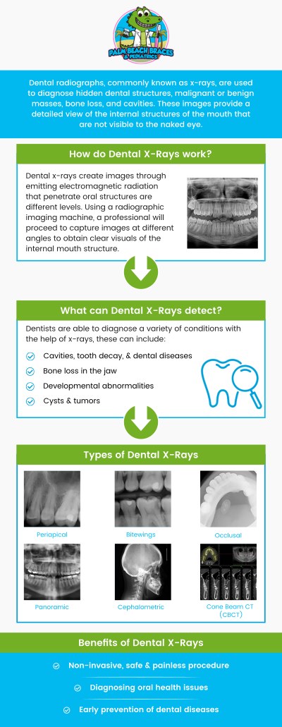 Common questions asked by patients: What is a dental X-ray, and why is it important for oral health? How often should you get a dental X-ray? Are dental X-rays safe, and do they involve any risks? What can a dental X-ray reveal that a regular examination might not? For more information, contact us or request an appointment online. We serve patients from Royal Palm Beach, FL, West Palm Beach, FL, and Lantana, FL Palm Springs FL, Greenacres FL, Wellington FL, Riviera Beach FL, Juno Beach FL, Delray Beach FL, and surrounding areas. Common questions asked by patients: What is a dental X-ray, and why is it important for oral health? How often should you get a dental X-ray? Are dental X-rays safe, and do they involve any risks? What can a dental X-ray reveal that a regular examination might not? For more information, contact us or request an appointment online. We serve patients from Royal Palm Beach, FL, West Palm Beach, FL, and Lantana, FL Palm Springs FL, Greenacres FL, Wellington FL, Riviera Beach FL, Juno Beach FL, Delray Beach FL, and surrounding areas.