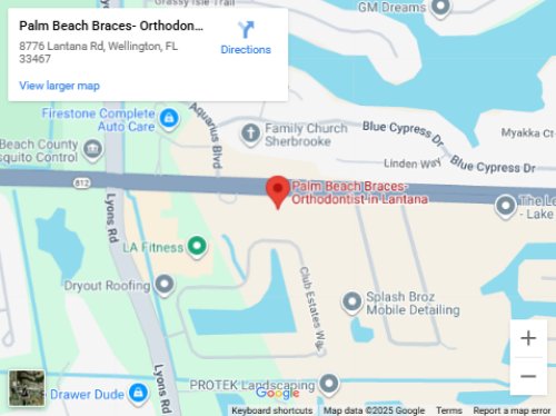 Welcome to Palm Beach Braces in Lantana, FL Welcome to Palm Beach Braces in Lantana, FL