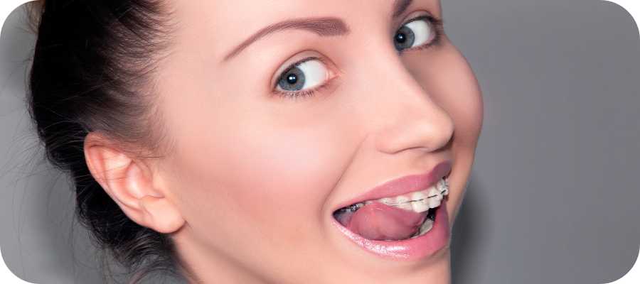 Post: Life with Braces – 5 Essential Tips for Eating, Cleaning, and Comfort Post: Life with Braces – 5 Essential Tips for Eating, Cleaning, and Comfort